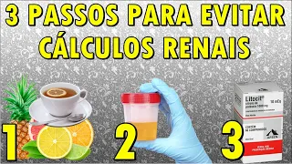 3 DICAS de PREVENÇÃO dos Cálculos RENAIS de REPETIÇÃO