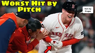 MLB | Hit By Pitch April 2024 part 2