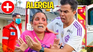 UMA COISA MUITO BIZARRA ACONTECEU COM MEU ROSTO! - ALERGIA GRAVE!