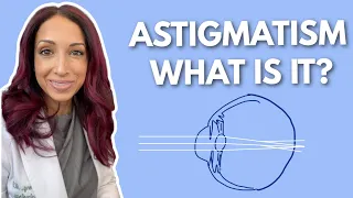 What Is Astigmatism? Eye Doctor Explains