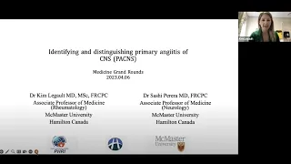 Central Nervous System Vasculitis - Hamilton Health Sciences Medical Grand Rounds