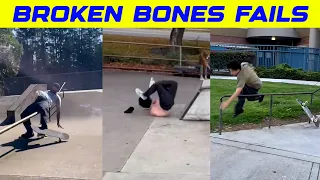 BROKEN BONES FAIL ( SKATEBOARDING FAIL EDITION )