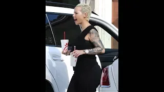 First Pics of Amber Rose After Breast Reduction Surgery