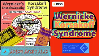 Wernicke's Korsakoff Syndrome