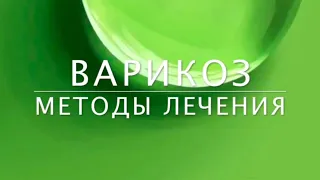 Как определить варикоз? Врач флеболог о симптомах и методах лечения.