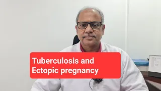 TB हुई थी, एक्टोपिक pregnancy हुई। अब क्या करें Questions Taken 19.10.2023