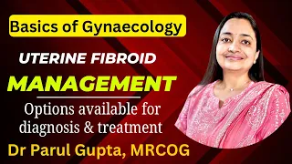Uterine Fibroid: Diagnostic modalities and treatment options ||