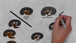 Diferenciação corticomedular renal