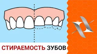 WASTE OF TEETH | The reasons. Effects. Treatment.