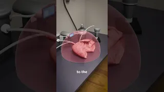 How Donor Lungs Are Kept Fresh 🤨