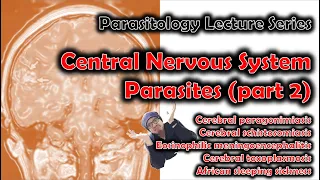 CNS Parasites (part 2) #parasites #brain