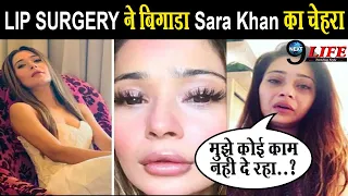 LIP SURGERY बिगड़ने के बाद बुरी तरह टूट चुकी हैं Sara Khan, बोली 'एक साल तक मैंने काम नही...||