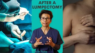 6 Things to expect following a lumpectomy with Dr Tasha