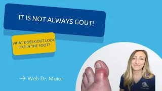 It is not alway Gout