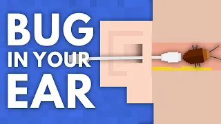 What If a Bug Gets Stuck In Your Ear?