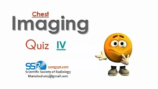 14 chest quiz (II) -prof.Mamdouh Mahfouz (2019 edition)