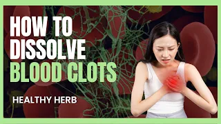 7 Natural Remedies to dissolve BLOOD CLOTS & Boost Vascular Health!