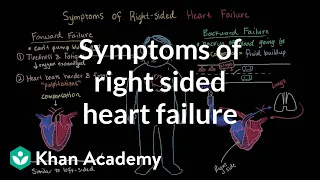 Symptoms of right sided heart failure | Circulatory System and Disease | NCLEX-RN | Khan Academy