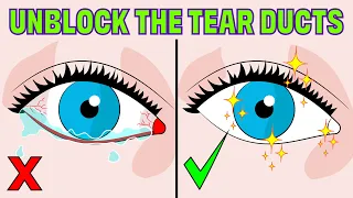 How to Fix a Blocked Tear Duct WITHOUT having Surgery!