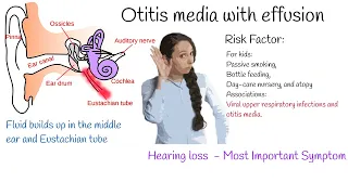 Otitis media with Effusion  - Most common cause of hearing loss in kids