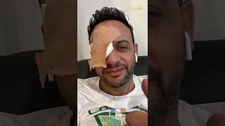 سبب إصابة مصطفى قمر وتوقف تصوير حريم كريم