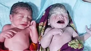 Twin baby boy and girl after birth where boy is 10 minutes old while Girl is just few seconds old