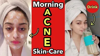 🌞Morning skin care routine for Oily & Acne prone Skin + Anti-acne drink 😍💫 #shorts #youtubeshorts