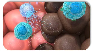 THE IMMUNE SYSTEM KILLS CANCER CELLS!  THIS IS HOW!