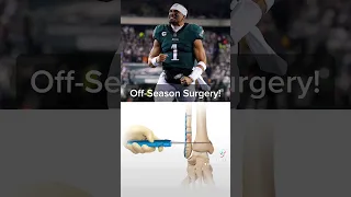 Jalen Hurts off-season ankle surgery. Expert explains | #jalenhurts #philadelphiaeagles #nfl