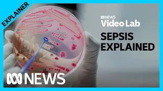 Sepsis explained: Why the exact causes of this life-threatening condition are a mystery  | ABC News