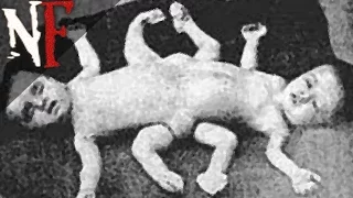 5 Most Disturbing Human Experiments