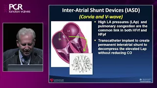 Going beyond boundaries in structural heart interventions?