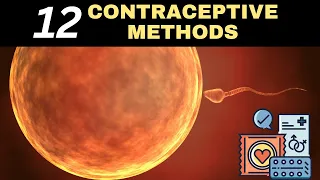 Choosing the Right Contraceptive: A Deep Dive into 12 Birth Control Methods