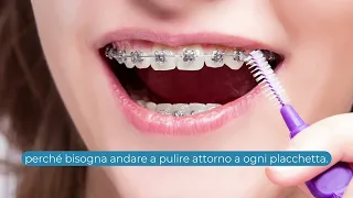 Tutorial prima visita ortodontica - dott. Edoardo Matteoda - OdontoSalute