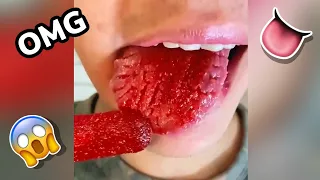 Orthodontist Reacts! INSANE Fissured Tongue 😳 #Shorts