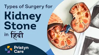 Types of Surgery for Kidney Stones in Hindi