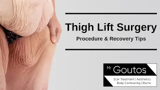 Thigh lift Surgery - Procedure and Recovery Tips