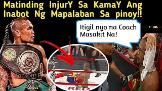 MATINDING INJURY NATAMO SA KAMAY NG MAPALABAN SA PINOY