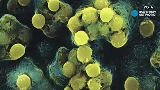 How flesh-eating bacteria works