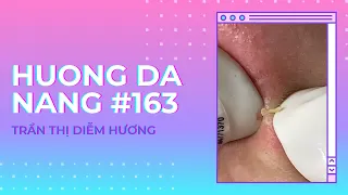 #163 | Huong Da Nang