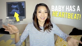 BABY HAS A HEARTBEAT! | Preggy Vlog (7 weeks)