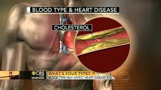 Blood type may be linked to heart disease risk: study