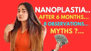 Results of Nanoplastia after 6 months? 🫢 | Which Shampoo to use? 😧 | Hair fall ? | Detailed Review