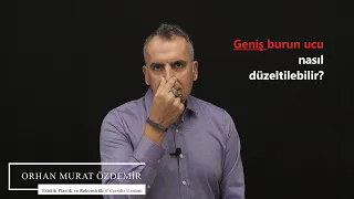 Geniş burun ucu nasıl düzeltilir?