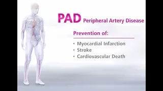 What is Peripheral Artery Disease - Mechanism of Disease