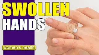 What Causes Swollen Hands? | Reduce Swelling