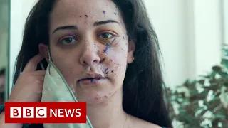 Fixing the scars of Beirut's explosion - BBC News