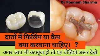 दांतों में फिलिंग(FILLING) या कैप (CAP) क्या करवाना चाहिए,Tooth filling/tooth capping kya better hai