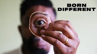 My Eye Was Pushed Out Of My Skull | BORN DIFFERENT