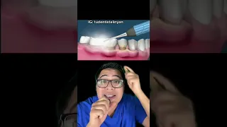 mira EL SARRO como destruye TUS DIENTES 😥